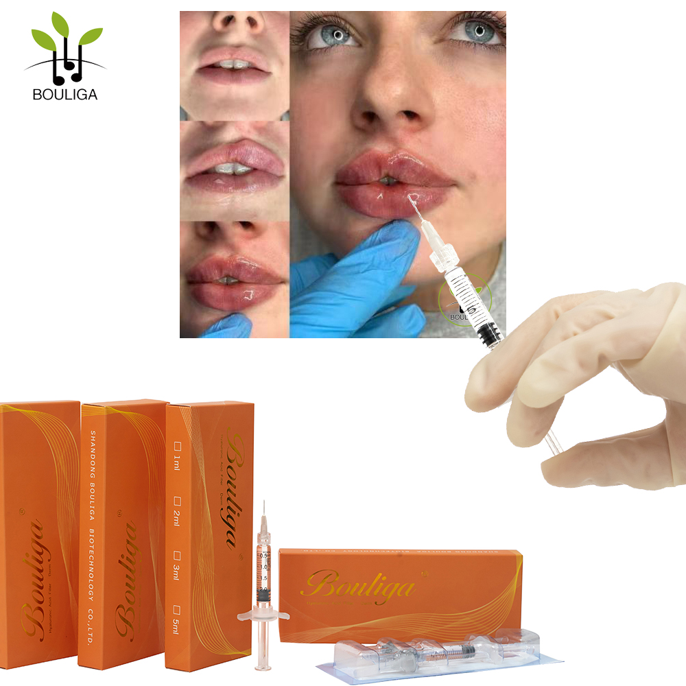 Bouliga Superior Hyaluronic Acid Dermal Filler 5 мл Нехирургический наполнитель для улучшения губ
